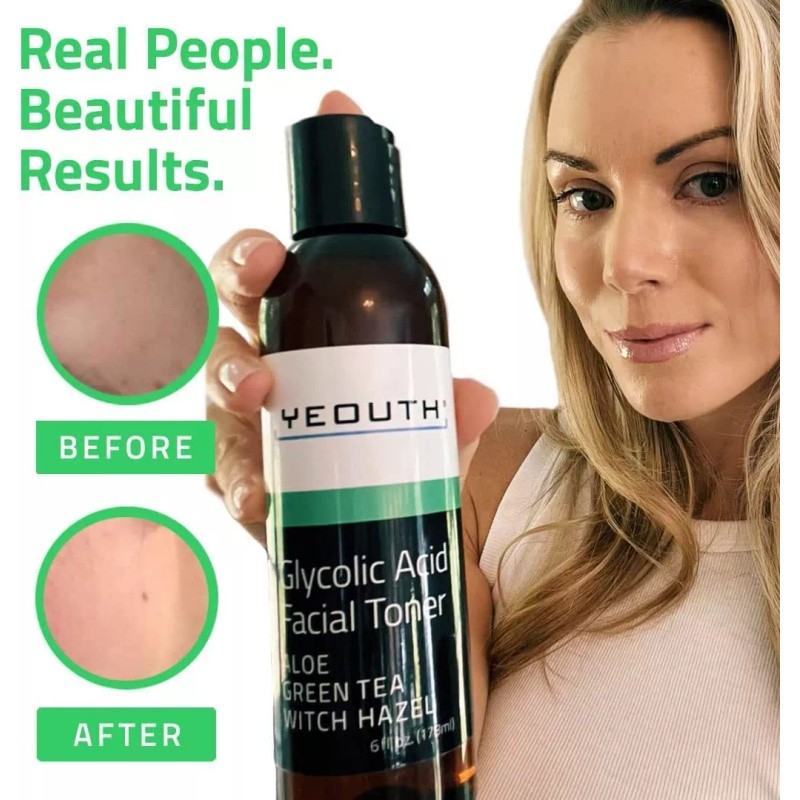 Yeouth - Tóner De Ácido Glicólico Para Cara Con Hamamelis