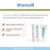 VARESIL Varicose veins - 5 Varesil Cream: Cream to relieve