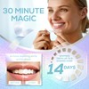 Venus Visage Teeth Whitening Strips 28 Strips (14 Pack), Professional