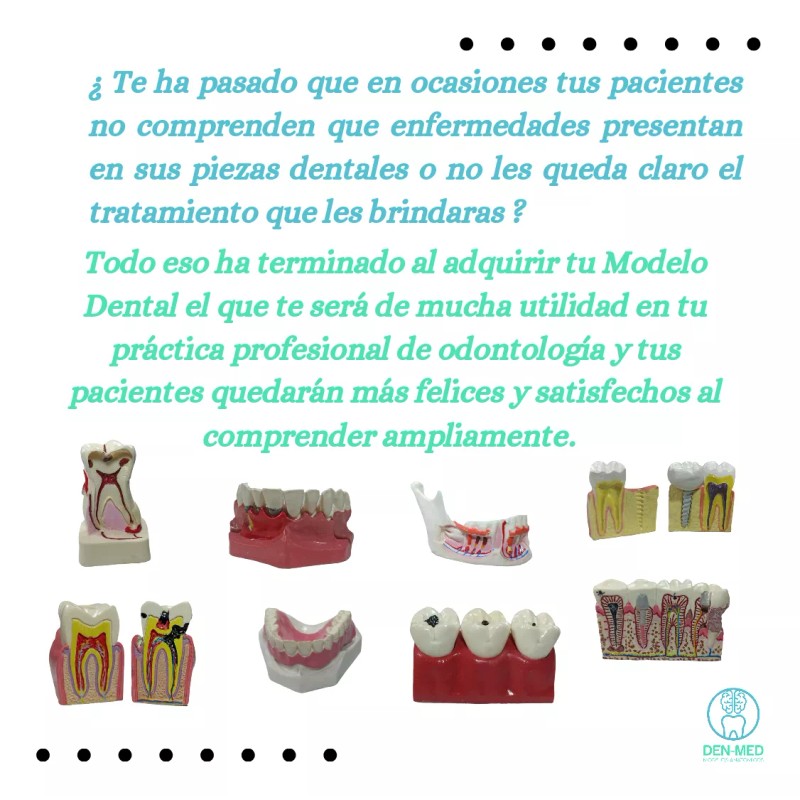 Den Med Modelo Dental Gingivitis