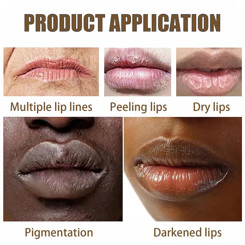 Moisturizing Lip Exfoliator and Lightening Scrub - Removes Dead Skin,