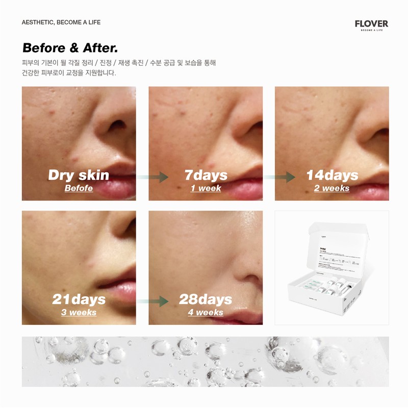 Hickstein 🎁Tool🎁 Hickstein Skin Correction Ampoule (Heextein) 28days Hickstein Skin
