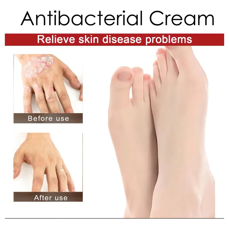 Pomada Herbal Antibacterial para Cuidado de la Piel Sensible Irritación,