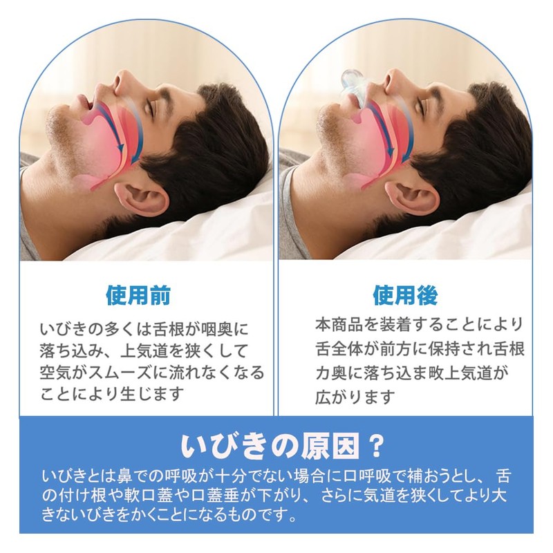 いびき防止グッズ 2個入り 舌用マウスピース 睡眠の質改 騒音対策 無呼吸症候群 口呼吸 舌ピタ 自宅 出張