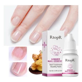 Para Uñas Antifúngico A Base De Jengibre Onicomicosis Hongos