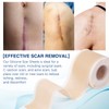 Silicone Scar Sheets (1.6”x 130”, 3.3M), Professional Silicone Scar Tape,