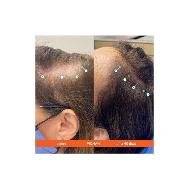 DS Laboratories | Revita® Shampoo para la Densidad Capilar Refill