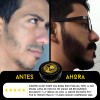 Tratamiento Barba 20% Cierra Huecos Densidad Ultra Potente Menta