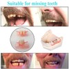 Dentures Fake Teeth DIY Kit Easy and Convenient DIY Fake