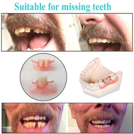 Dentures Fake Teeth DIY Kit Easy and Convenient DIY Fake Teeth Repair Missing Teeth or DIY Full Denture Kit Fake Teeth Top and Bottom Temporary Fake Teeth