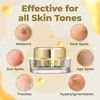 ABERA Melasma Cream (Premium Version) - Cream for Face Treatment,