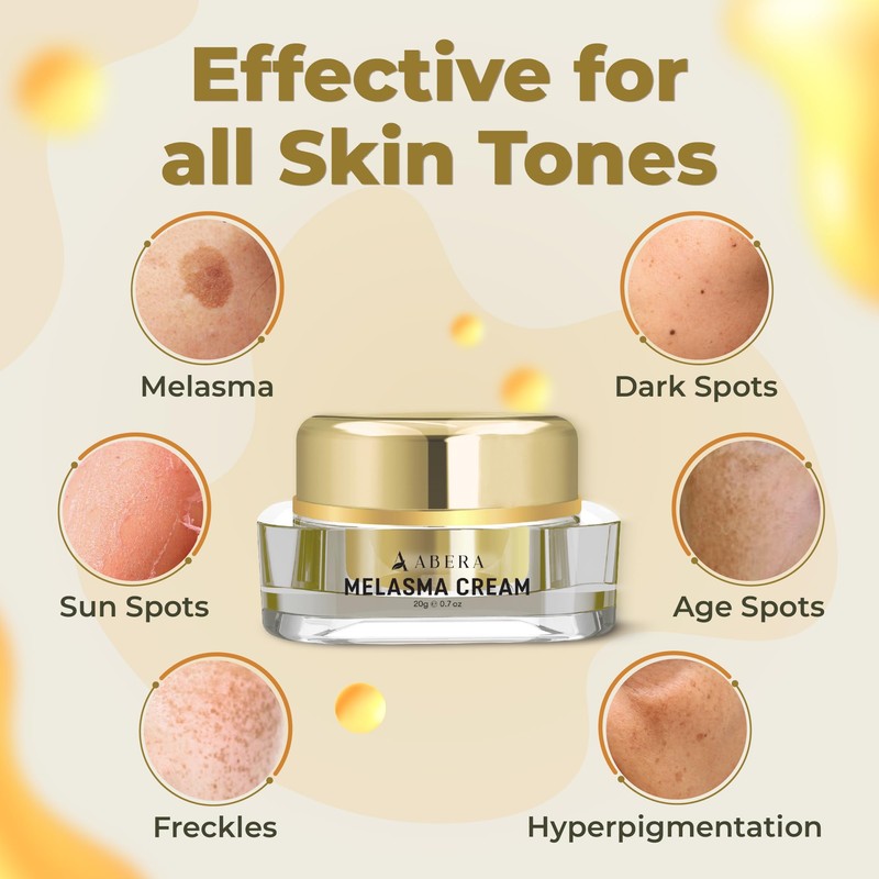 ABERA Melasma Cream (Premium Version) - Cream for Face Treatment,