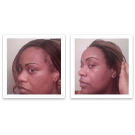 Caboki Hair Concealer (All-Natural Hair Building Fibers) Travel Size (Black)