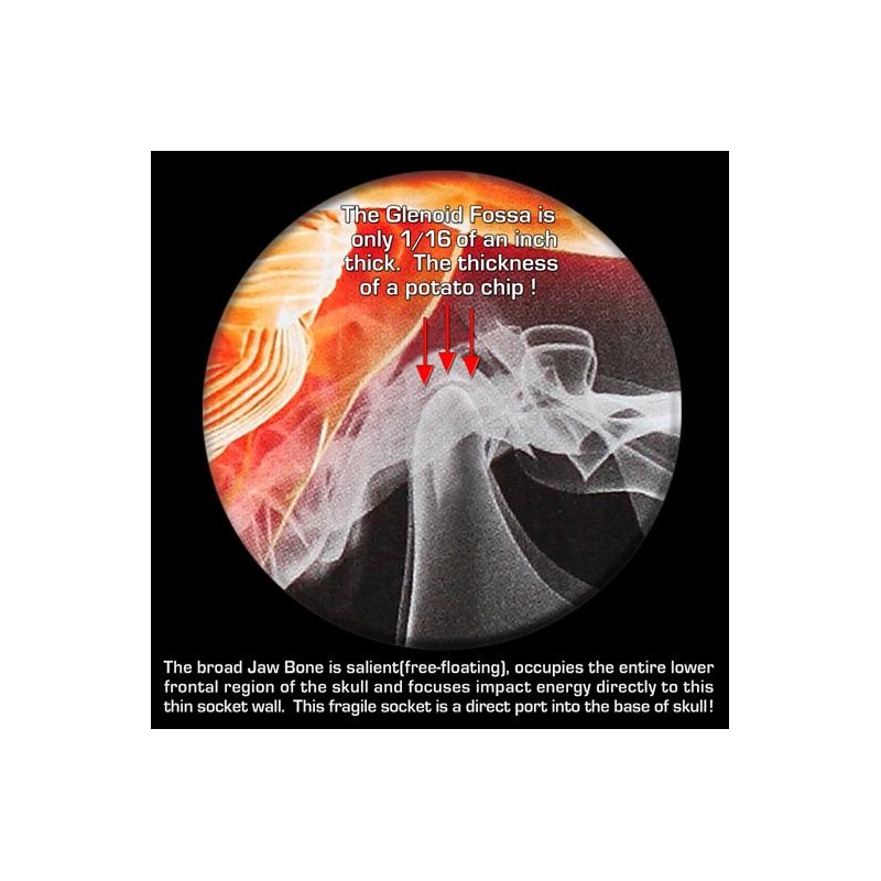 Brain-Pad High Performance Power Lifter Mouthguard