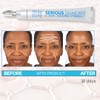 Serious Skincare - Dr. Mark Pinsky - Trace + Erase