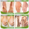 Callus and Dead Skin Remover Crema Para Callos del Pie