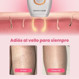 ShinnySkin - Depiladora Lser Profesional IPL para Todo el Cuerpo - Eliminacin del Vello Sin Dolor - 5 Niveles de Intensidad - Resultados Notorios en  