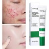 Crema Ácido Salicílico Control Acné Piel Grasa 20g