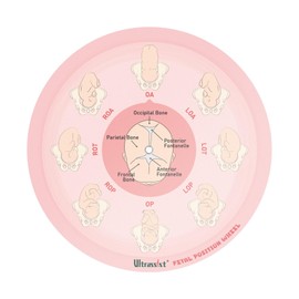 Ultrassist Midwife Fetal Position Tool - Large Size, Fetal Position Wheel for Midwives, Doula and Obstetricians Gifts, Childbirth Education Tool for Medical & Nursing Students
