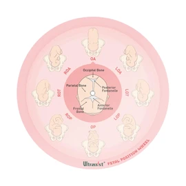 Ultrassist Midwife Fetal Position Tool - Large Size, Fetal Position Wheel for Midwives, Doula and Obstetricians Gifts, Childbirth Education Tool for Medical & Nursing Students