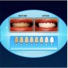 20 MINUTOS Blanqueador Dental 20 Minutos Con Lampara Ultra Violeta