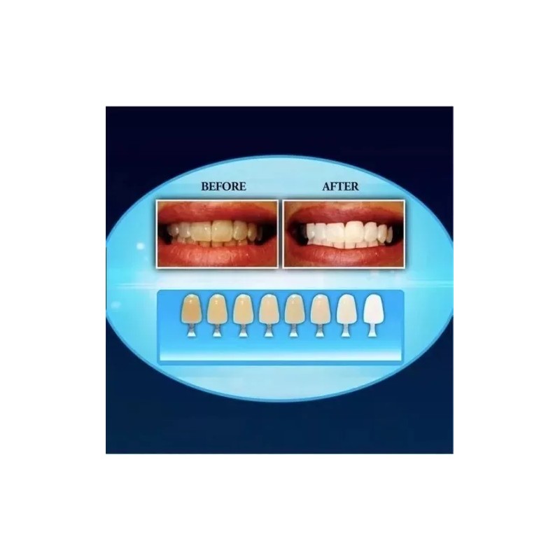 20 MINUTOS Blanqueador Dental 20 Minutos Con Lampara Ultra Violeta