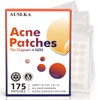 AUSLKA Acne Pimple Patches (175 Patches), Hydrocolloid Acne Pimple Patch