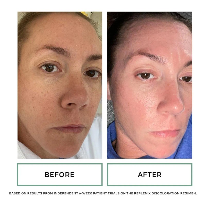 Replenix Peeling Facial Con Ácido Glicólico, Almohadillas Fa