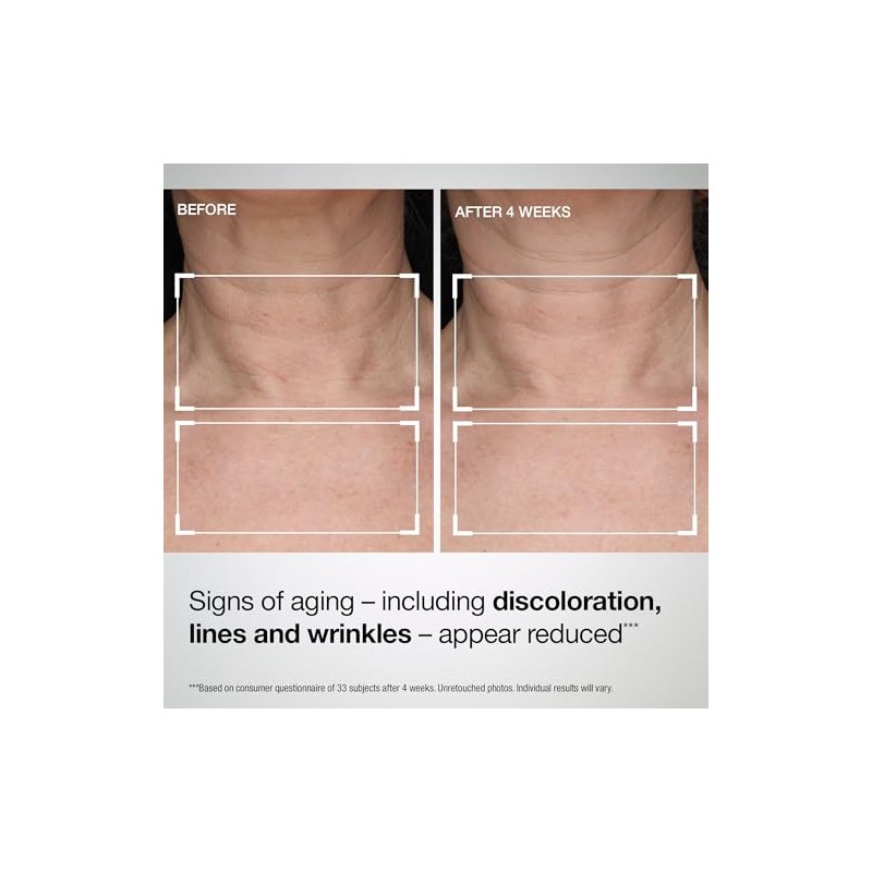 StriVectin TL Advanced Loción Reafirmante para Cuello y Escote con