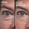 Dr. Brandt Needles No More, No More Baggage - Minimizes
