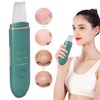 EMS Ultrasonic Skin Scrubber Blackhead Pimple Removal Lifting Ion Pore