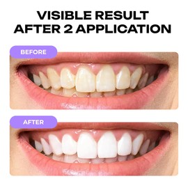 Colour Balancing Tooth Foam 50ml with Mild Ingredients for Daily Oral Care and a Naturally Radiant Smile Without Abrasive Agents or Harsh Chemicals