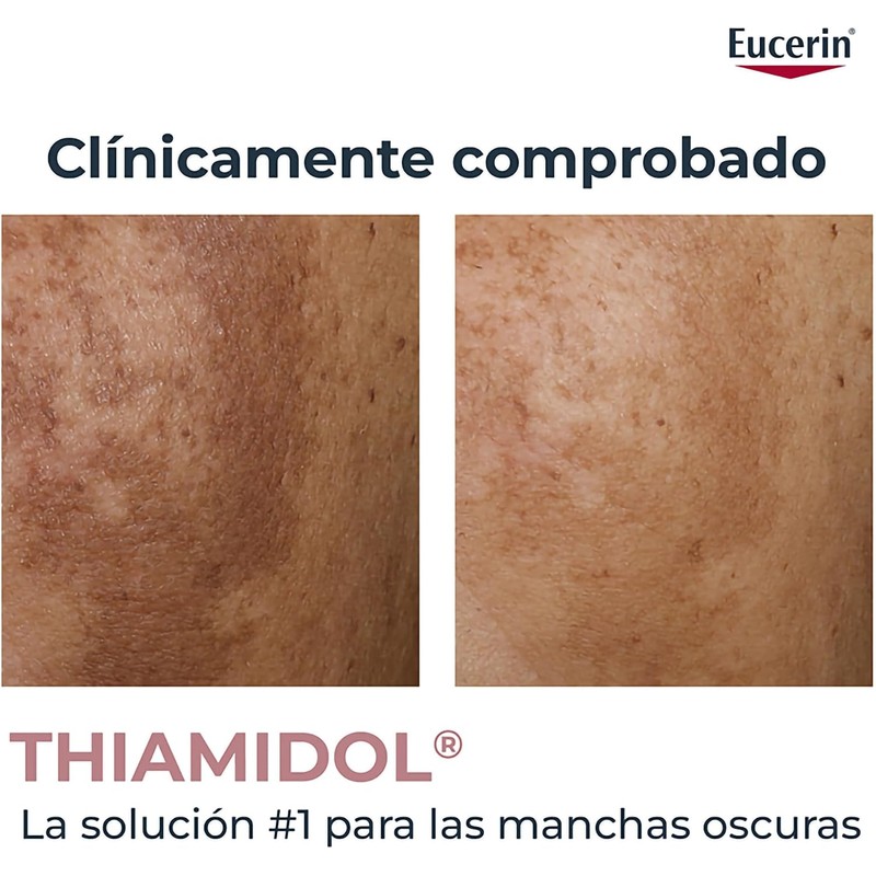EUCERIN Anti-Pigment Crema Corporal para Áreas Específicas (200ml) Ayuda a