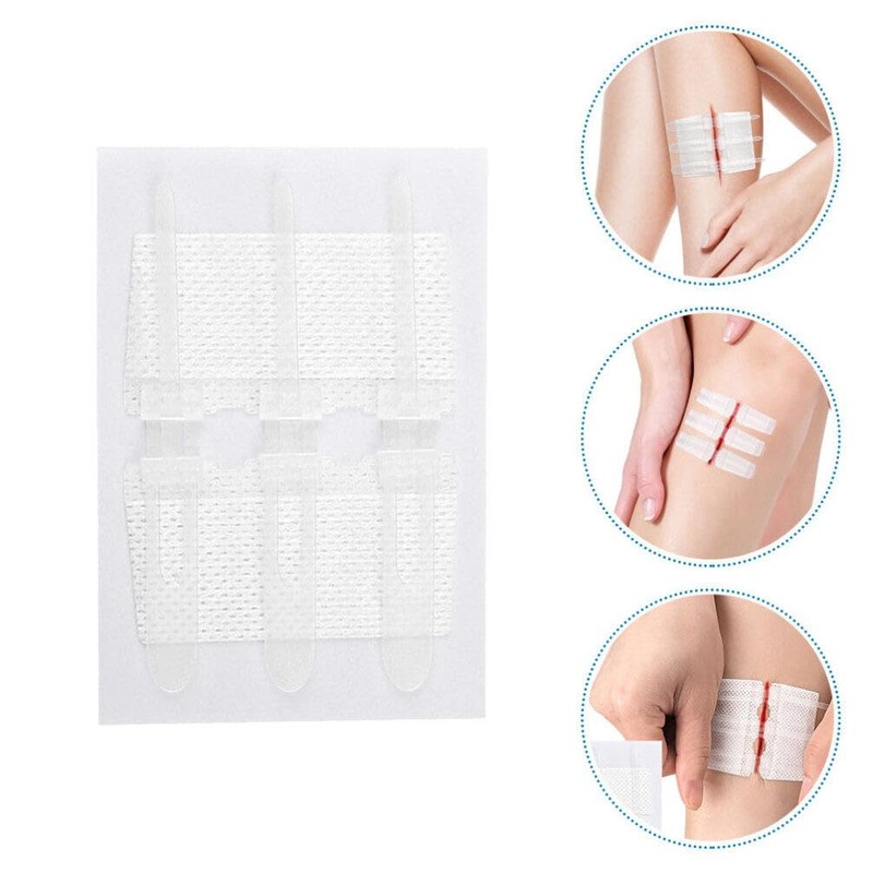 Beavorty 1 Set Zip Stitch with Wound Dresssings WoundClosure Strips