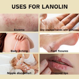 3PCS Natural Lanolin Cream for Hands & Foot,Foot Moisturizer for Dry Cracked Feet/Skin,Lanolin Nipple Cream Lip Balm for Discomfort &Eczema,Skin Barrier Repair Skin Cream Multi-Purpose Soothing Lotion