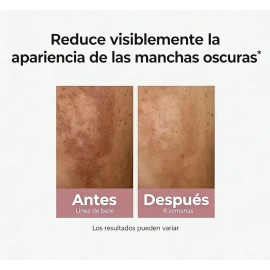 Eucerin Suero Facial Anti-pigment 30ml Con Thiamidol
