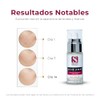 Acne Away Crema Aclarante Anti Acne 40 ml