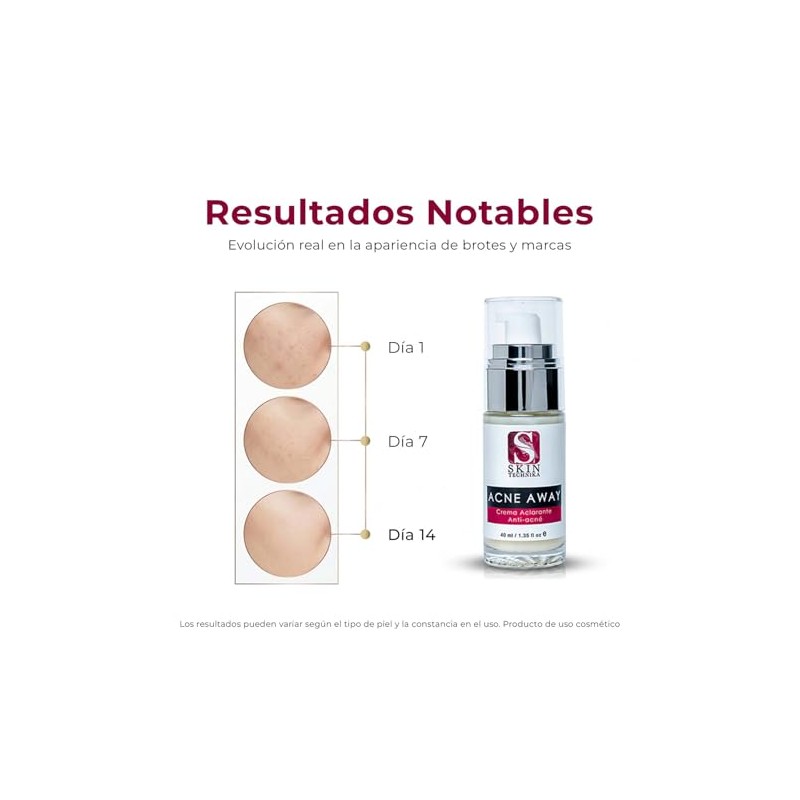 Acne Away Crema Aclarante Anti Acne 40 ml
