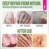 CHUCHU Nail Repair and Growth Serum: Natural Plant Strengthening Serum