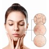 Loción Facial Calmante Y Desensibilizante Azuleno Ph6 125 Ml