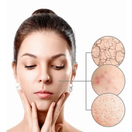 Loción Facial Calmante Y Desensibilizante Azuleno Ph6 125 Ml                                                                                          