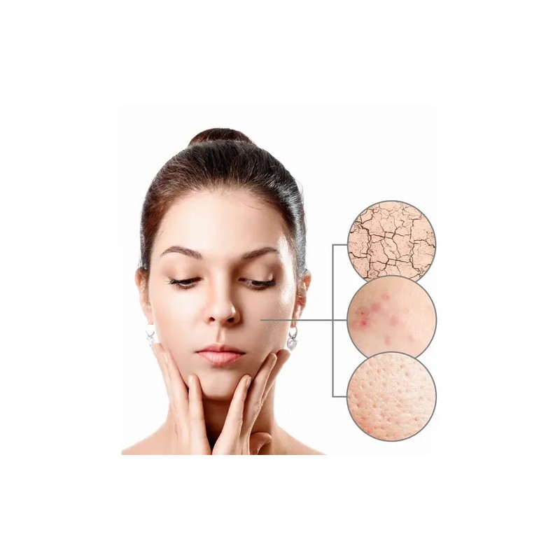 Loción Facial Calmante Y Desensibilizante Azuleno Ph6 125 Ml