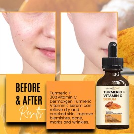 Dermaxgen® TURMERIC FACE SERUM + VITAMIN C + HA + ALOE - PIGMENTATION CORRECTOR - 4 FL OZ