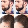 Derma Roller 0.25 Mm Facial Cabello O Rodillo Para Barba