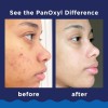 Panoxyl Acné Foaming Wash 10% Peróxido De Benzoilo 156 G