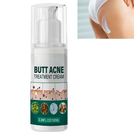 KOAHDE Buttock Whitening Pimples Treatment, Butt Pimple Whitening Treatment, Butt Pimples Cream 100ml