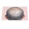 Man Bald Micropigmentattion Practice Skin Silicone Hairline Microblading Practice Pads