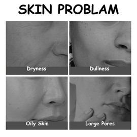 345 Relief Cream - Face Cream For Women - Face Moisturizer For Acne & Repair Damage Skin - Barrier Repair Cream Soothing Face Cream For Most Skin Type - Face Cream For Mature Skin 2PCS