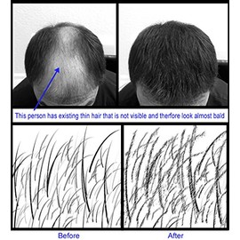 Dark Blonde Samson Best Hair Loss Concealer Building Fibers Refill Kit With 25grams USA refills all brands