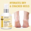 Sequedad, Agrietamiento Y Descamación De Los Pies Con Crema